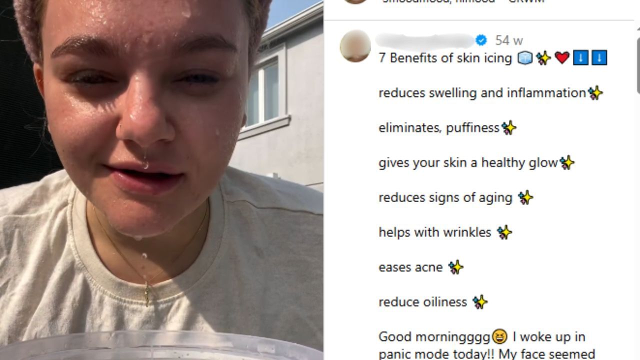 Ice facial